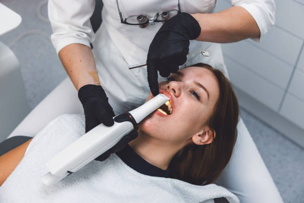 Teeth Whitening in IA